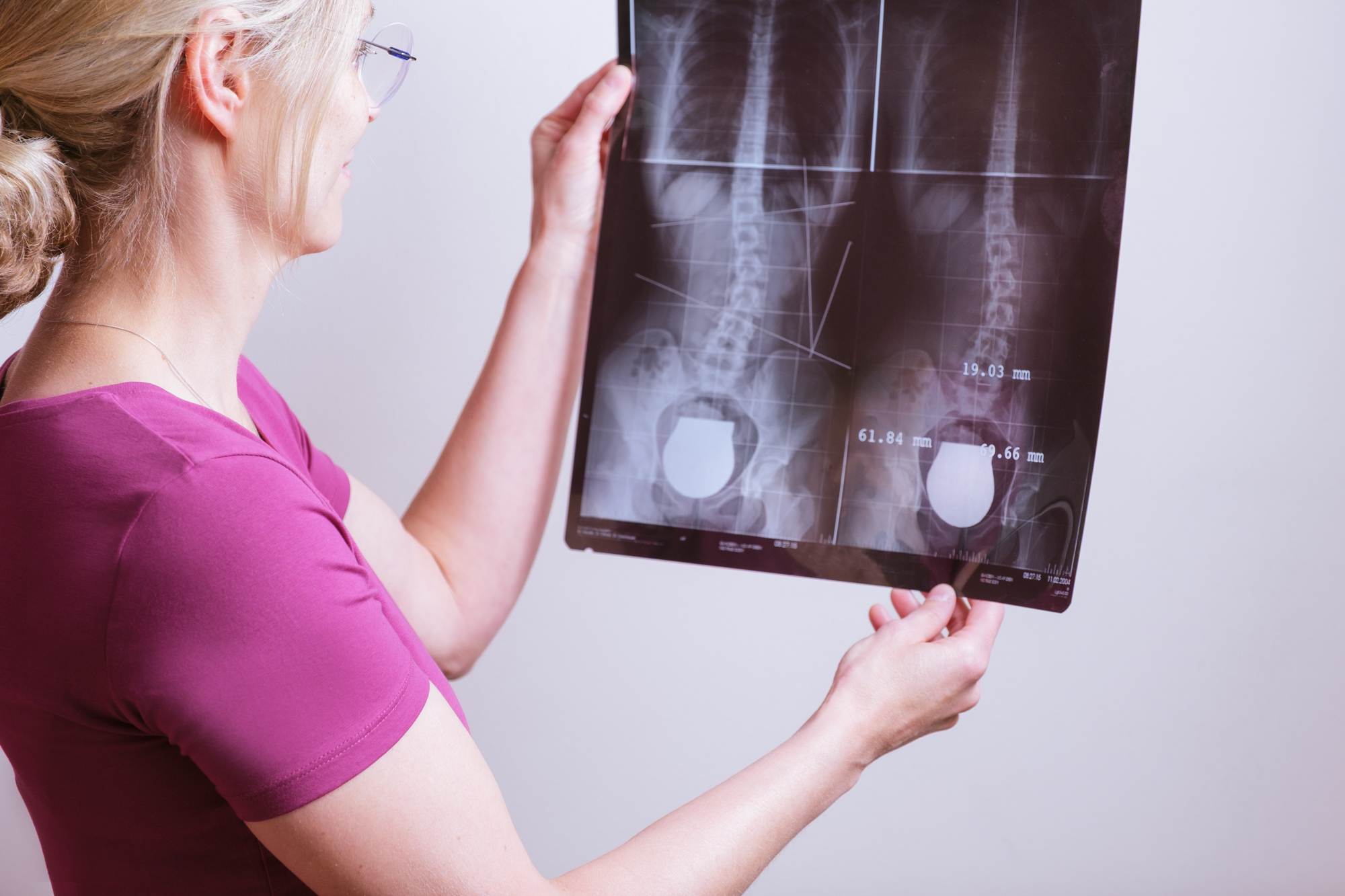 Skoliosetherapie - Maria Galanda-John im Therapiezentrum Weissenbach